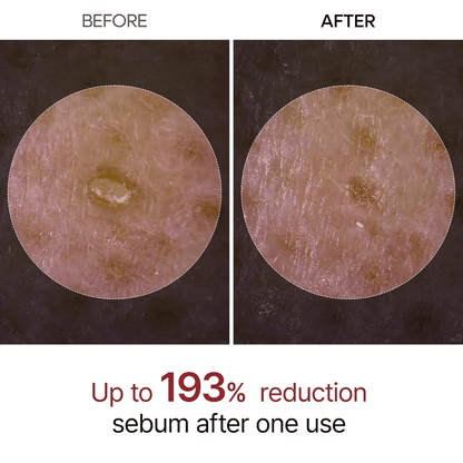 Rice Peel Glow Serum Ampoule